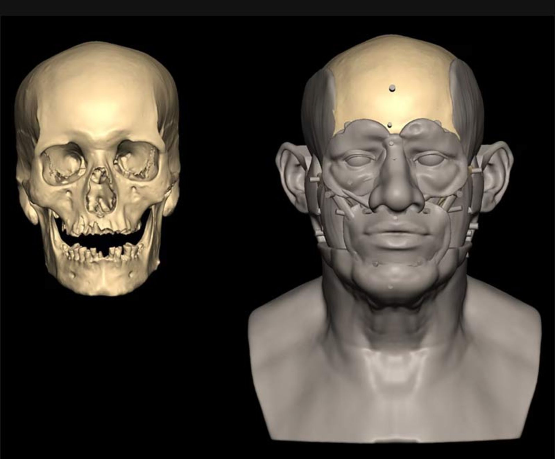کشفیات باستانشناسی سال ۲۰۲۵ که جهان را شگفتزده کرد 10 تصویر جمجمه و مراحل بازسازی چهره روی آن