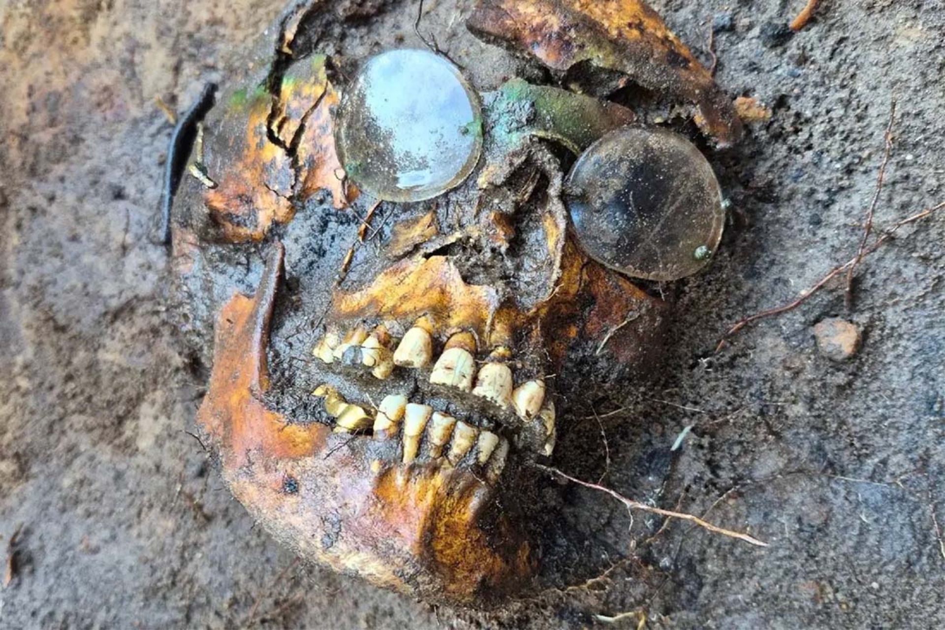 یک جمجمه با عینک‌های گرد باقی‌مانده بر روی آن